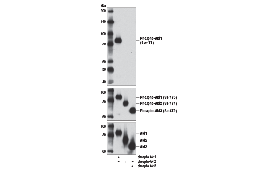  Image 17: Phospho-Akt Isoform Antibody Sampler Kit