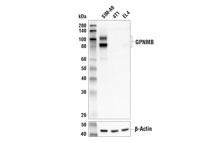  Image 9: Mouse Reactive Alzheimer's Disease Model Microglia Phenotyping IF Antibody Sampler Kit
