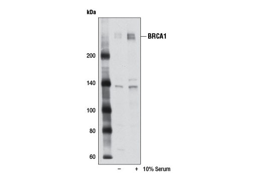 Western Blotting Image 2: BRCA1 (D54A8) Rabbit mAb
