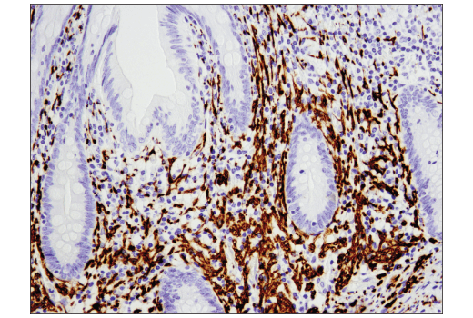 Immunohistochemistry Image 1: NCAM-L1 (D5D3K) Rabbit mAb
