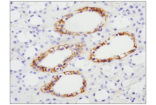 Immunohistochemistry Image 5: NCAM-L1 (D5D3K) Rabbit mAb