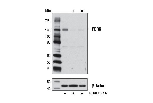  Image 1: SignalSilence® PERK siRNA II