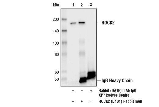 Immunoprecipitation Image 1: ROCK2 (D1B1) Rabbit mAb