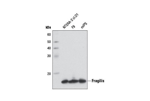 Western Blotting Image 1: Fragilis Antibody