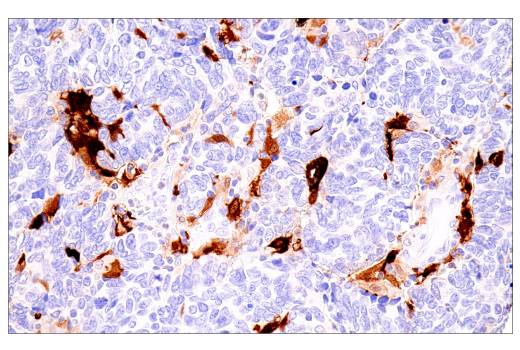 Immunohistochemistry Image 1: S100B (E7C3A) Rabbit mAb