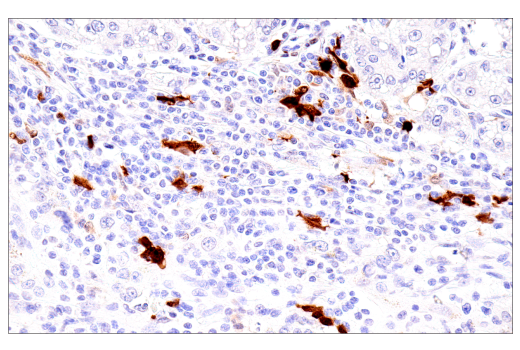 Immunohistochemistry Image 2: S100B (E7C3A) Rabbit mAb