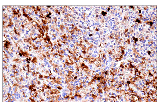Immunohistochemistry Image 8: S100B (E7C3A) Rabbit mAb