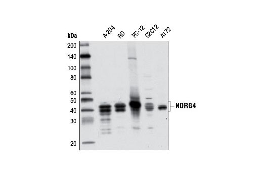  Image 15: NDRG Family Antibody Sampler Kit
