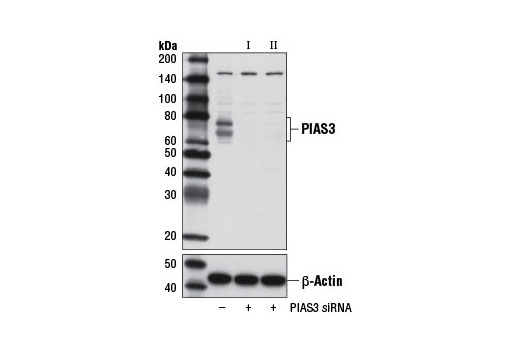  Image 8: Jak/Stat Pathway Inhibitors Antibody Sampler Kit