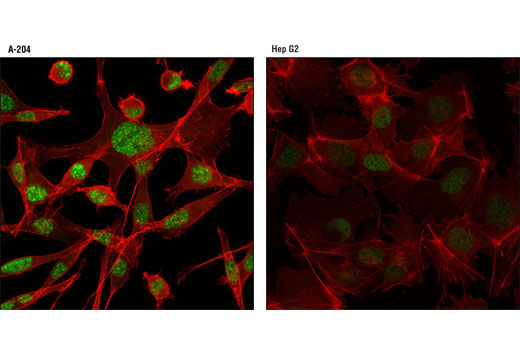 Immunofluorescence Image 1: PIAS3 (D5F9) XP® Rabbit mAb