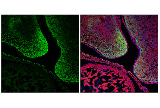 Immunofluorescence Image 1: TWIST1 (E5G9Y) Rabbit mAb