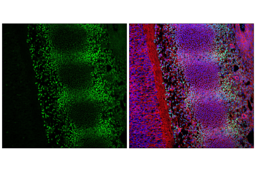 Immunofluorescence Image 2: TWIST1 (E5G9Y) Rabbit mAb