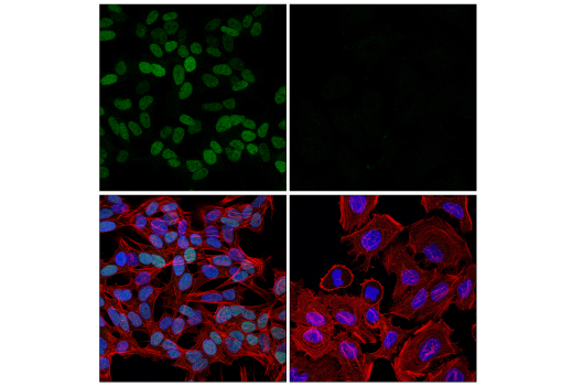 Immunofluorescence Image 3: TWIST1 (E5G9Y) Rabbit mAb