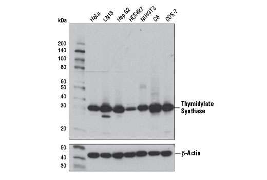 Western Blotting Image 2: Thymidylate Synthase (D5B3) XP® Rabbit mAb