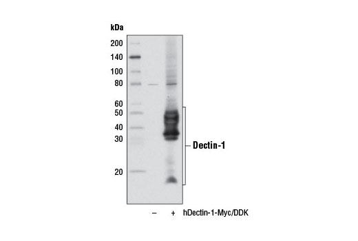 Western Blotting Image 1: Dectin-1 Antibody