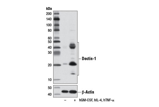 Western Blotting Image 2: Dectin-1 Antibody