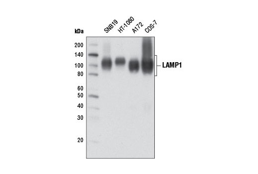  Image 16: PICALM Signaling Antibody Sampler Kit