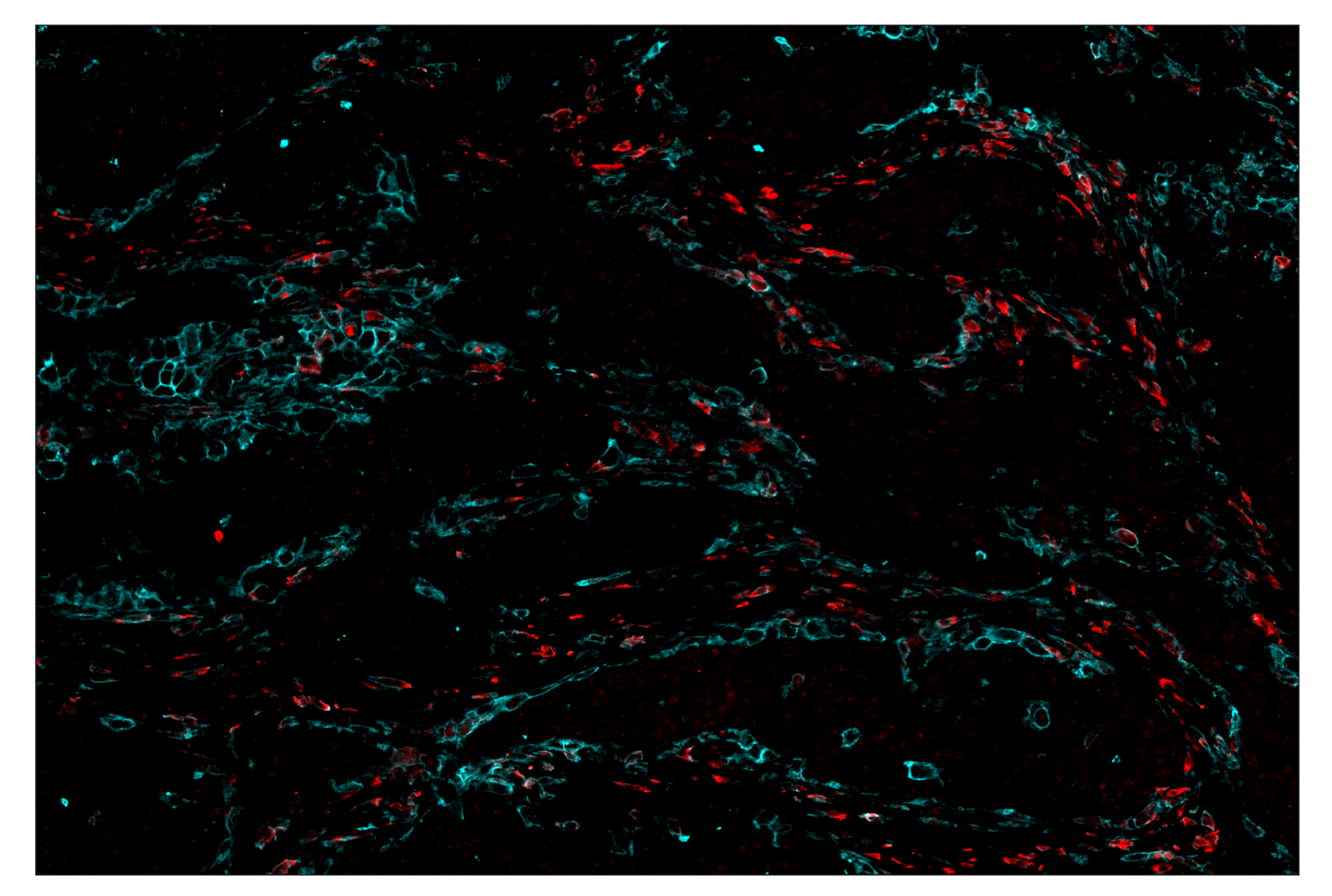 Immunohistochemistry Image 7: CD206/MRC1 (E2L9N) & CO-0035-488 SignalStar™ Oligo-Antibody Pair