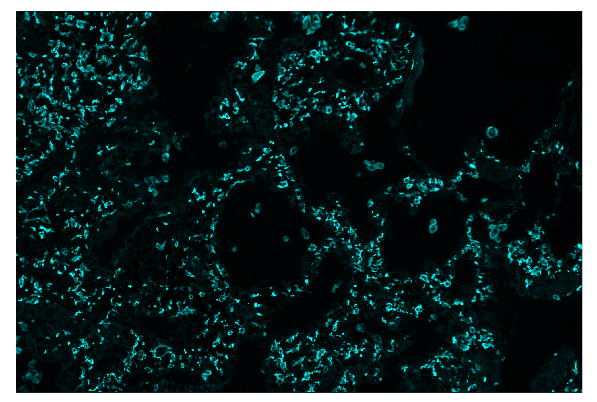 Immunohistochemistry Image 5: CD206/MRC1 (E2L9N) & CO-0035-647 SignalStar™ Oligo-Antibody Pair