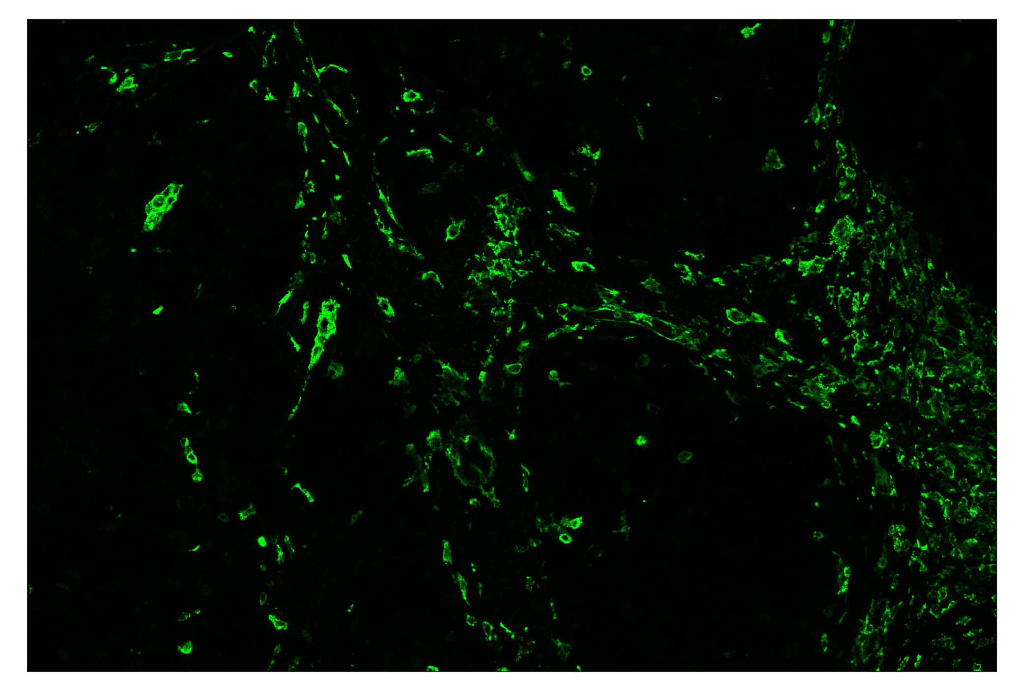 Immunohistochemistry Image 2: CD206/MRC1 (E2L9N) & CO-0035-488 SignalStar™ Oligo-Antibody Pair