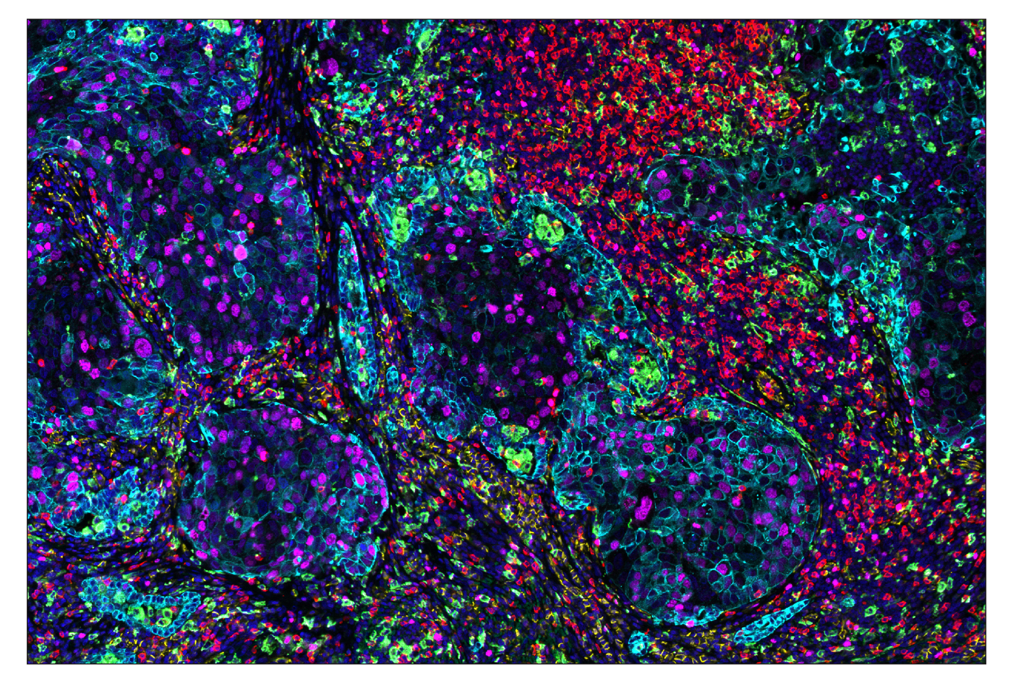 Immunohistochemistry Image 1: CD206/MRC1 (E2L9N) & CO-0035-750 SignalStar™ Oligo-Antibody Pair