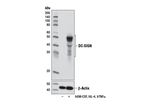 Western Blotting Image 1: DC-SIGN Antibody