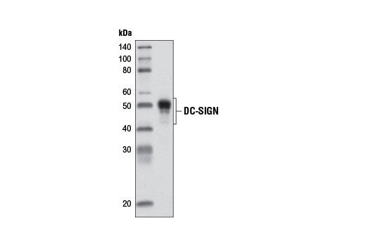Western Blotting Image 2: DC-SIGN Antibody