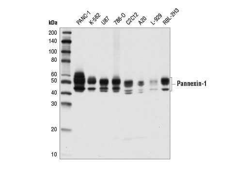 Western Blotting Image 1: Pannexin-1 (D9M1C) Rabbit mAb