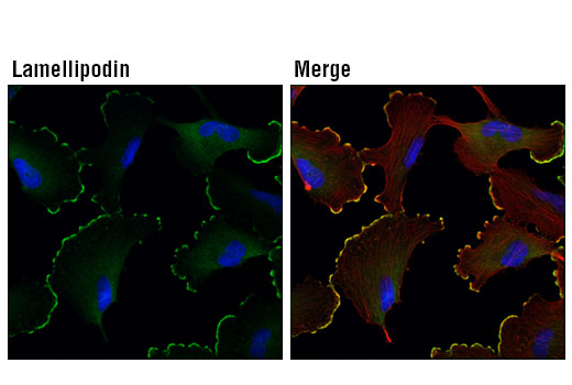 Immunofluorescence Image 1: Lamellipodin (D8A2K) Rabbit mAb