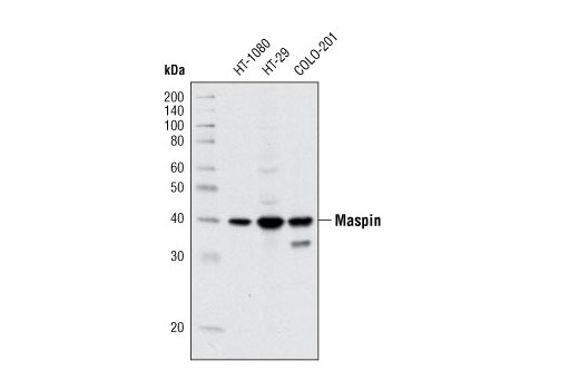 Western Blotting Image 1: Maspin (T50) Antibody
