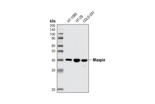 Western Blotting Image 1: Maspin (L250) Antibody