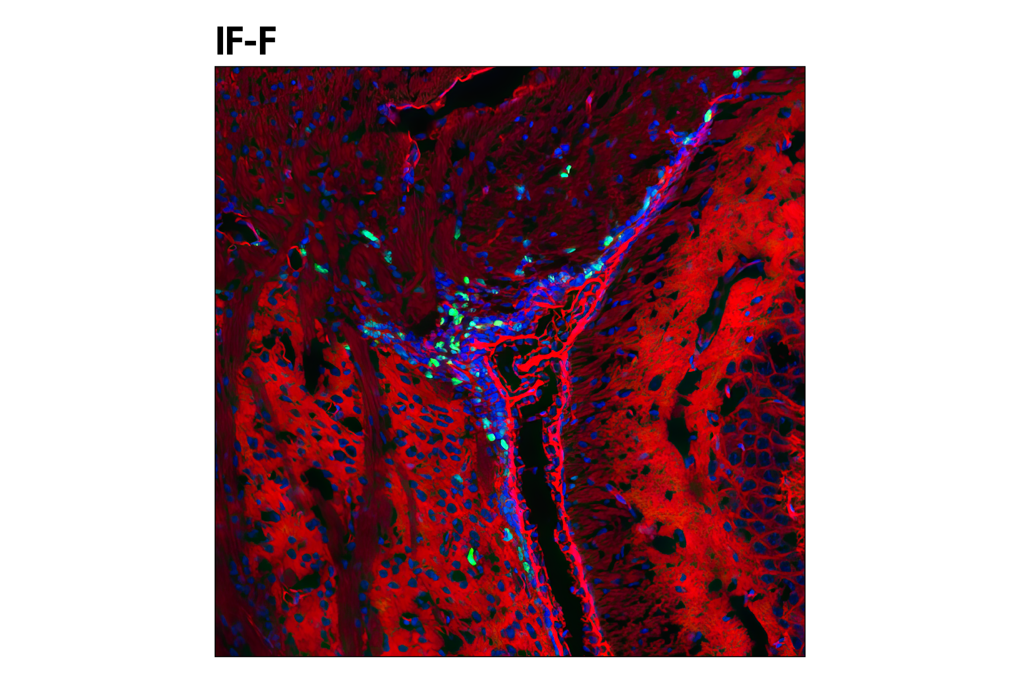  Image 13: Mouse Microglia Marker IF Antibody Sampler Kit