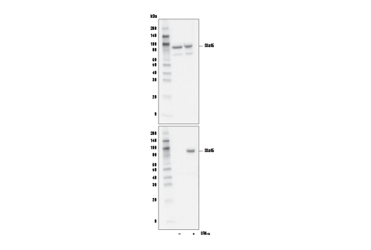 Western Blotting Image 3: Stat1/2/3/5 Control Cell Extracts