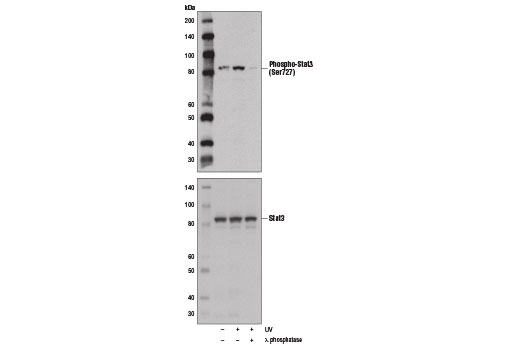  Image 8: Phospho-Stat Antibody Sampler Kit