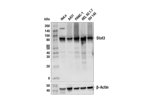  Image 12: PhosphoPlus® Stat3 (Tyr705) Antibody Kit