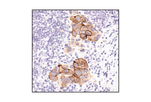 Immunohistochemistry Image 1: Phospho-HER2/ErbB2 (Tyr1221/1222) (6B12) Rabbit mAb (BSA and Azide Free)