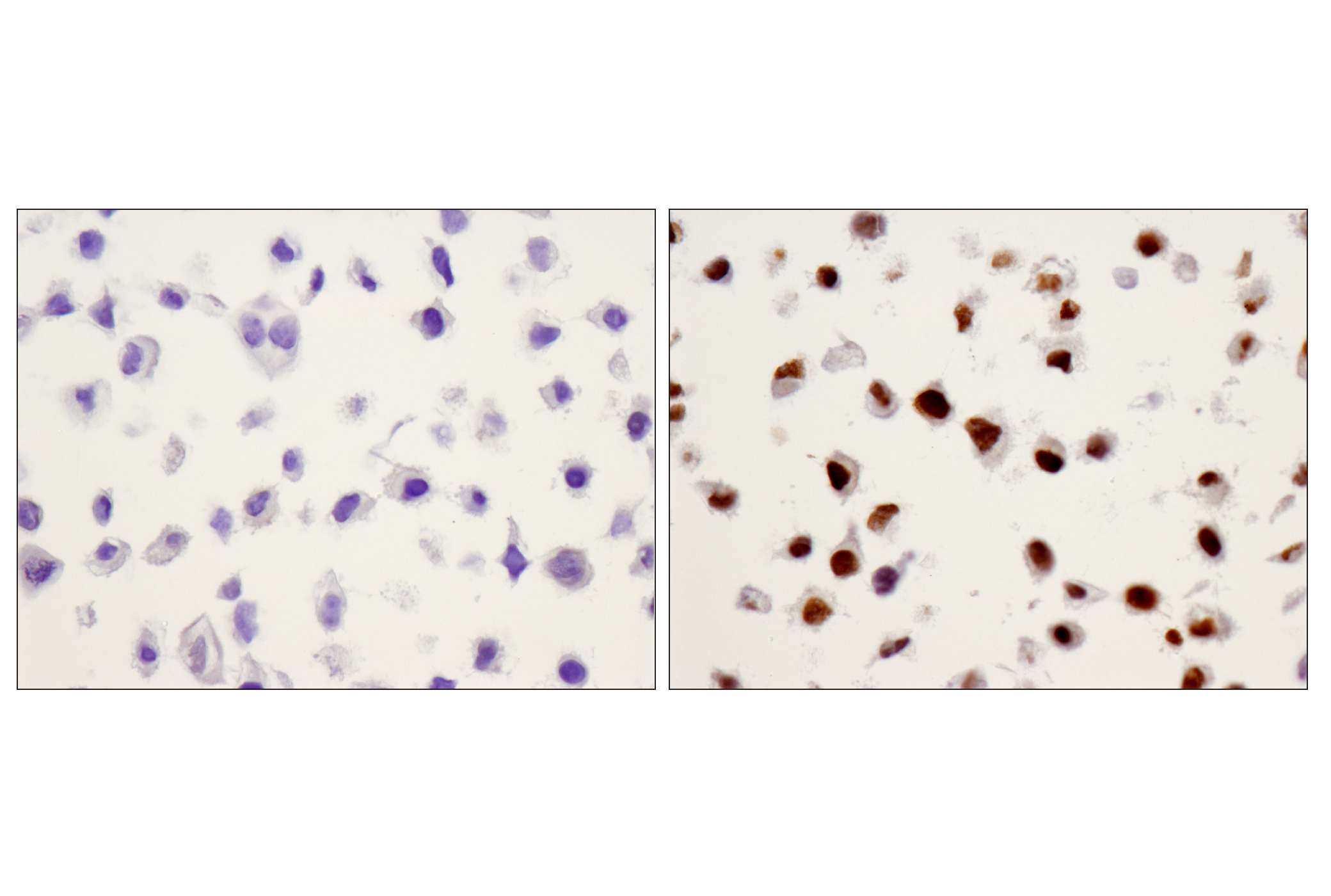  Image 17: PhosphoPlus® Stat3 (Tyr705) Antibody Duet