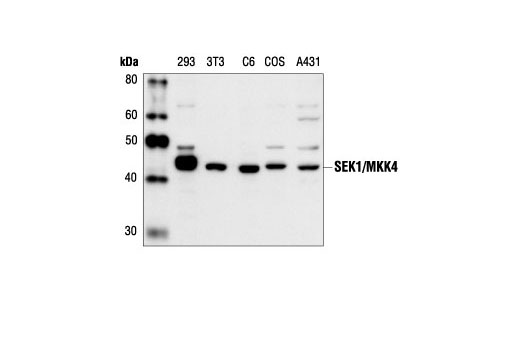Western Blotting Image 1: SEK1/MKK4 Antibody