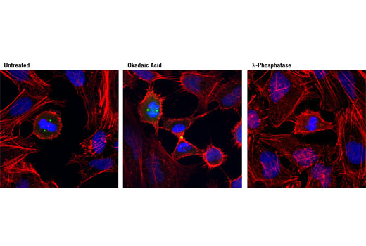 Immunofluorescence Image 1: Phospho-LATS1 (Thr1079) Antibody