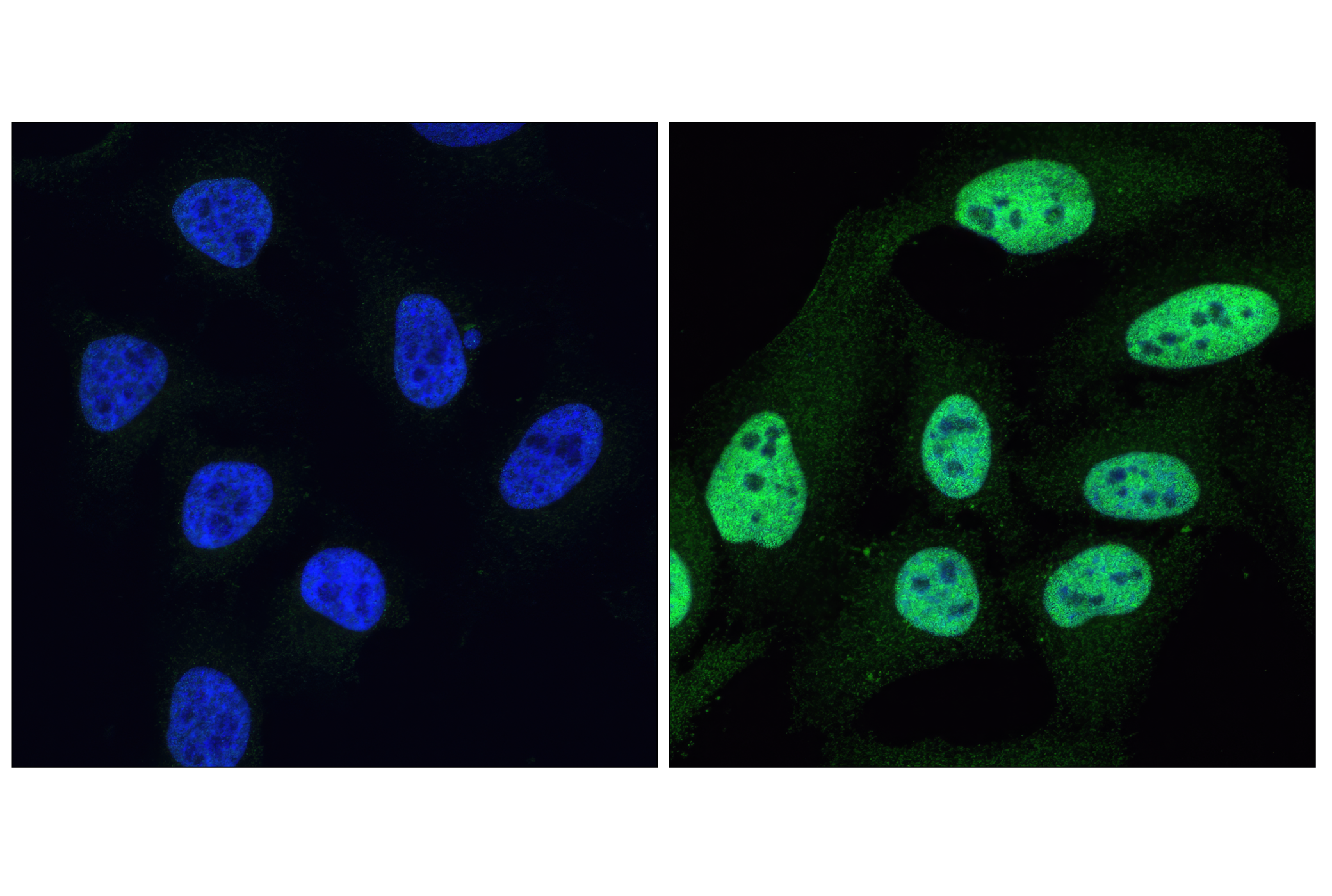 Immunofluorescence Image 1: Phospho-Stat1 (Tyr701) (58D6) Rabbit mAb
