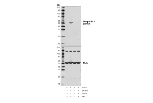  Image 17: Apoptosis/Necroptosis Antibody Sampler Kit II