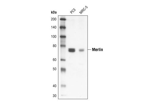 Western Blotting Image 1: Merlin Antibody