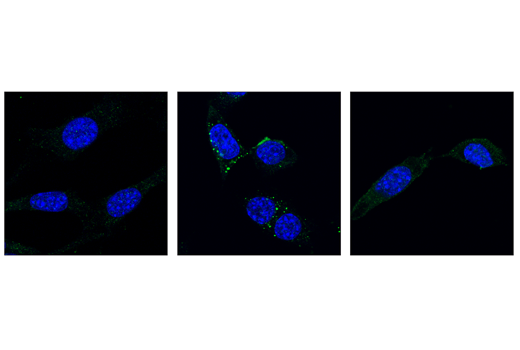 Immunofluorescence Image 1: Phospho-RIP3 (Thr231/Ser232) (E7S1R) Rabbit mAb