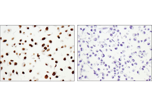  Image 51: BAF Complex IHC Antibody Sampler Kit