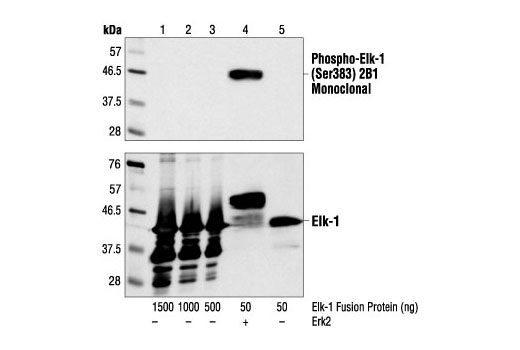 Western Blotting Image 1: Phospho-Elk-1 (Ser383) (2B1) Mouse mAb
