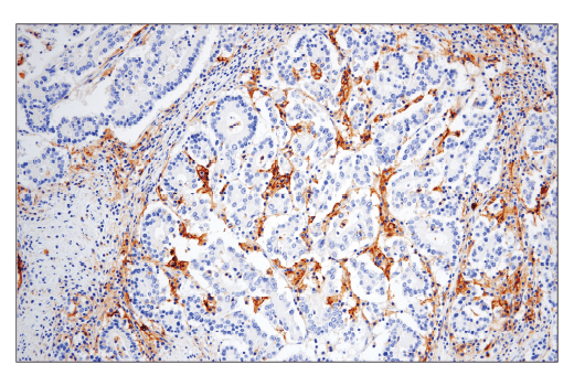  Image 43: Human Reactive M1 vs M2 Macrophage IHC Antibody Sampler Kit