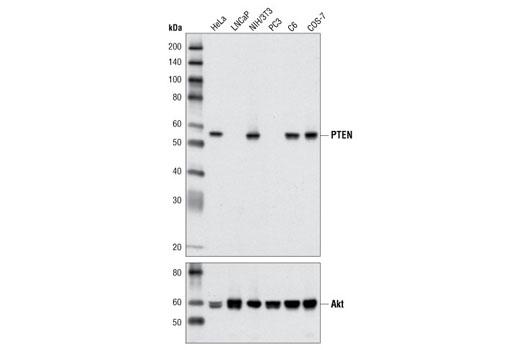  Image 6: PTEN and PDK1 Antibody Sampler Kit