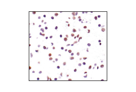  Image 7: PhosphoPlus® CREB (Ser133) Antibody Duet