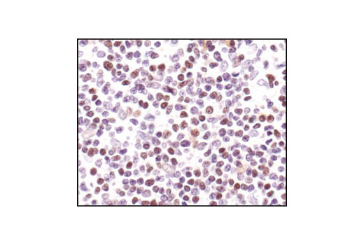  Image 14: PhosphoPlus® CREB (Ser133) Antibody Kit