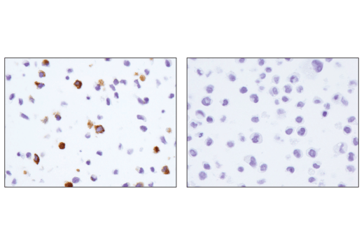 Immunohistochemistry Image 2: CD206/MRC1 (E2L9N) Rabbit mAb